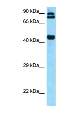 Polyclonal Rabbit anti-Human DPP4 / CD26 Antibody (aa663-712, IHC, WB)