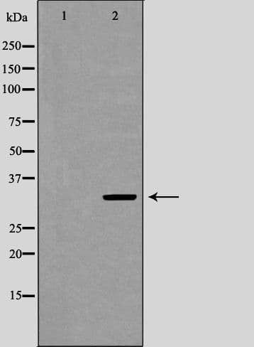 UCP3 Antibody
