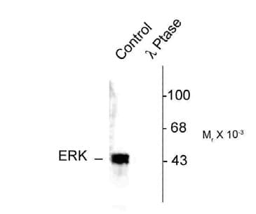 Polyclonal Rabbit anti-Rat MAPK3 / ERK1 Antibody (phospho-Thr202/Tyr204, IHC, WB)