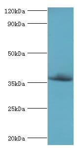 Polyclonal Rabbit anti-Human CFHR3 / CFHL3 Antibody (aa80-200, WB)