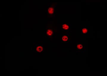 CCND2 / Cyclin D2 Antibody