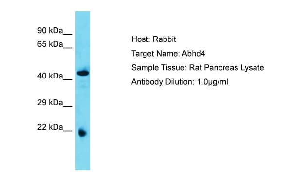 ABHD4 Antibody (aa80-129)