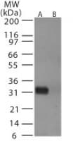 Polyclonal Rabbit anti-Influenza Virus Influenza A Virus Hemagglutinin Antibody (aa72-88, WB)