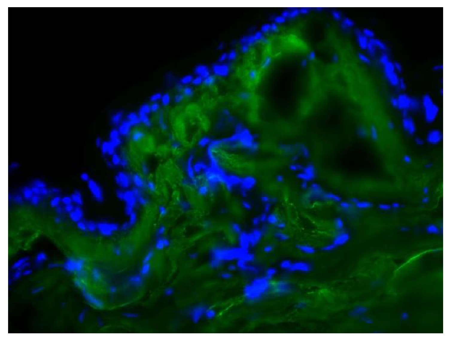 COL1A1 / Collagen I Alpha 1 Antibody (FITC)