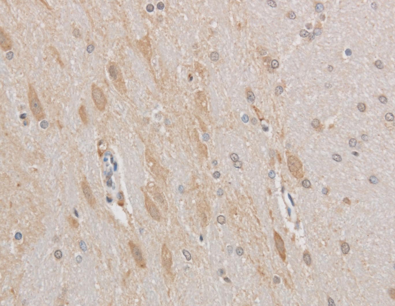 Polyclonal Rabbit anti-Human MAP2 Antibody (IHC)