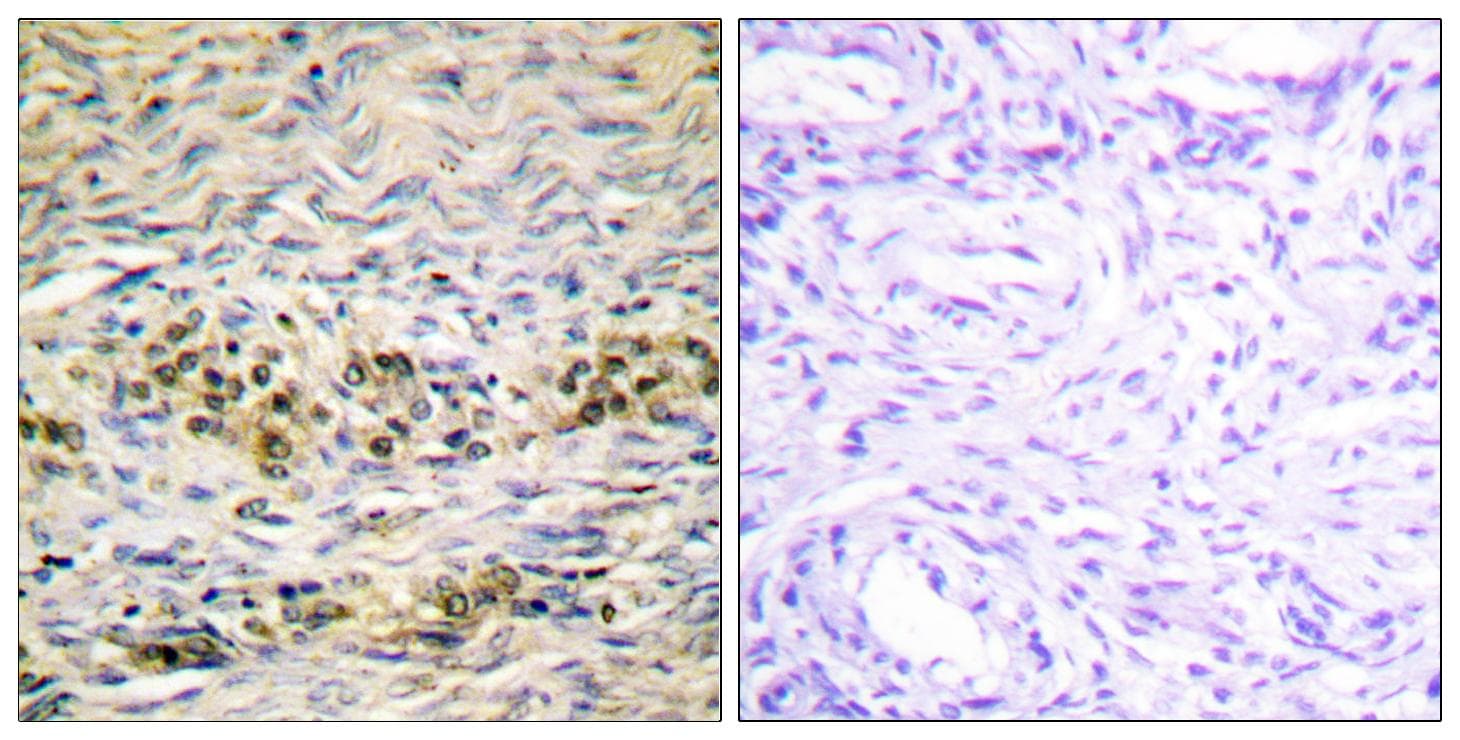 AKT1 Antibody (Ab-474)