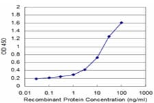 PIGQ Antibody (clone 2B7)