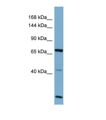 OCA2 / P protein Antibody (aa430-479)