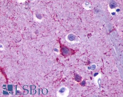 PathPlus™ ADGRF1 / GPR110 Antibody (N-Terminus)