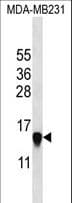Polyclonal Rabbit anti-Human HIST2H2AA3 Antibody (aa2-30, WB)