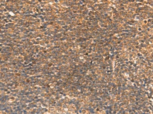STK32C / PKE Antibody