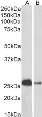 PathPlus™ Polyclonal Goat anti-Human CALB1 / Calbindin Antibody (aa59-72, IHC, WB)