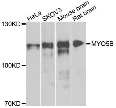 MYO5B / Myosin VB Antibody