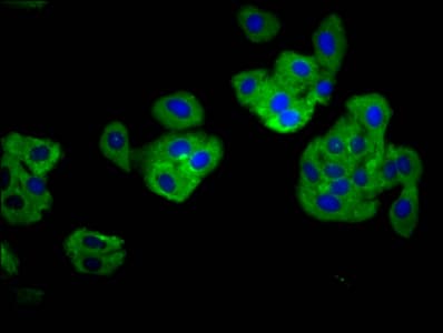 TNFRSF18 / GITR Antibody