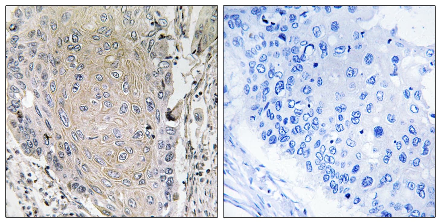 CBLN3 / Cerebellin 3 Antibody (aa131-180)