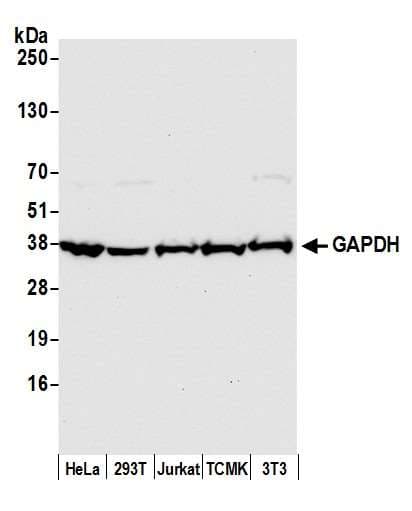 Polyclonal Rabbit anti-Human GAPDH Antibody (aa150-200, IHC, WB)
