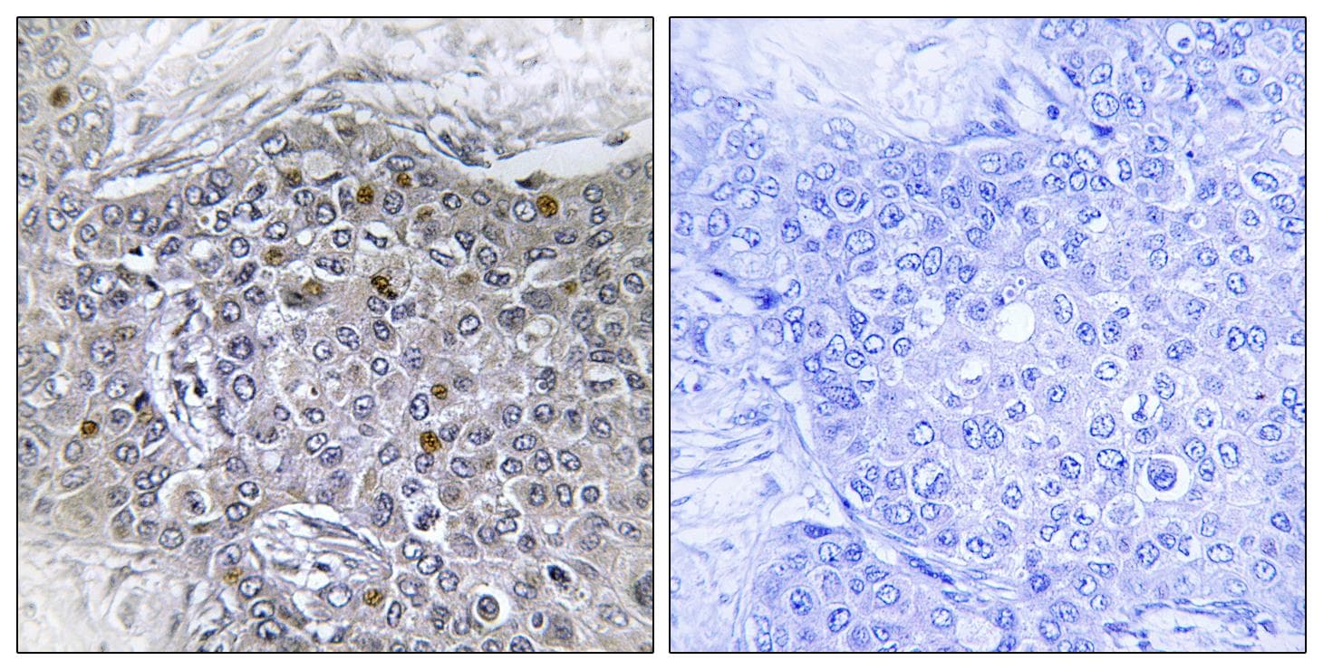 ZMYND11 / BS69 Antibody