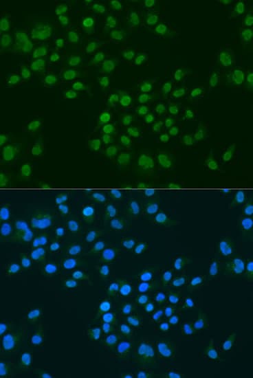 CIRP / CIRBP Antibody