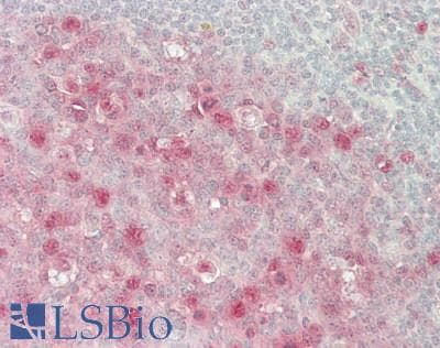 IHC-plus™ IPO7 / RANBP7 Antibody (aa200-250)