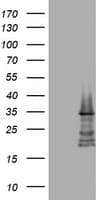 Monoclonal Mouse anti-Human ABCB1 / MDR1 / P Glycoprotein Antibody (clone OTI2C7, IHC, WB)
