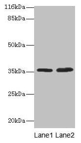 ACKR1 / DARC Antibody (aa1-63)