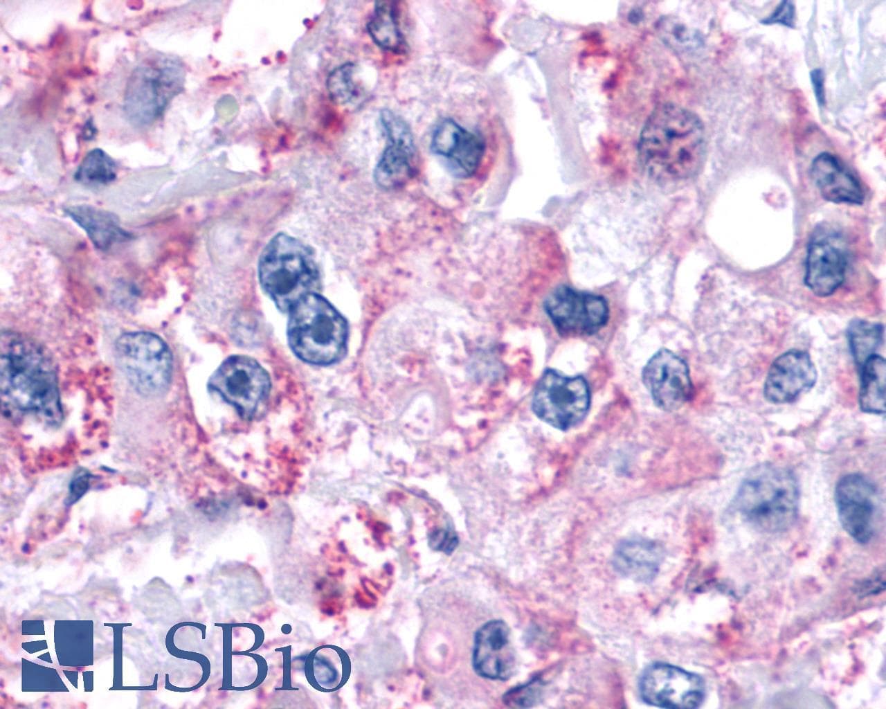 IHC-plus™ F2RL1 / PAR2 Antibody (N-Terminus)