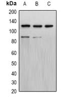 PR / Progesterone Receptor Antibody (Internal)