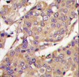 Polyclonal Rabbit anti-Human UBE2L6 Antibody (aa123-153, IHC, WB)
