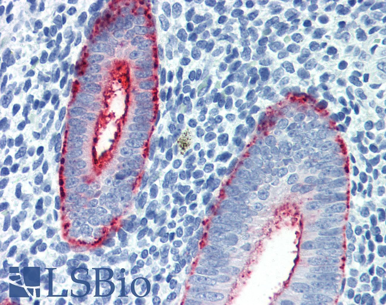 PathPlus™ Monoclonal Mouse anti-Human MUC16 / CA125 Antibody (clone X325, Extracellular Domain, IHC, WB)