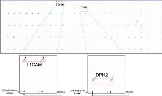 L1CAM Antibody (clone UMAB47)