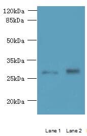 TMEM38B Antibody