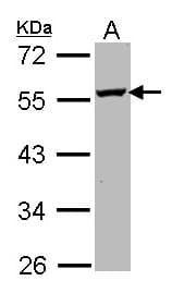 IHC-plus™ ODC1 / Ornithine Decarboxylase Antibody (aa180-461)