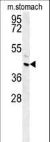 Polyclonal Rabbit anti-Human FAM26E Antibody (aa214-243, WB)