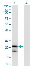 IL1RN Antibody (clone 1H5)