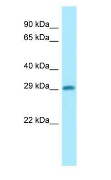 DHRS4 / PSCD Antibody (aa53-102)