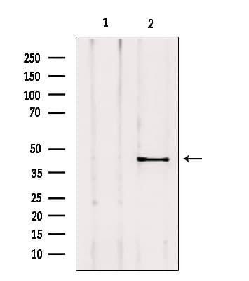 Polyclonal Rabbit anti-Human AKAP5 / AKAP79 Antibody (IF, WB)