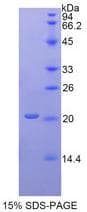 Human ACPP / PAP Protein (Recombinant His)