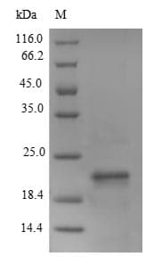 Mouse SCA2 / LY6E Protein (Recombinant 6His-B2M, N-terminus)