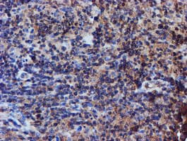 IDS / Iduronate 2 Sulfatase Antibody (clone OTI4G2)