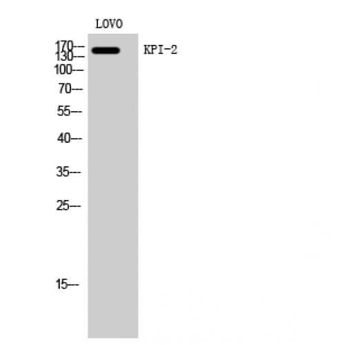 KPI-2 / LMTK2 Antibody (620-700 aa, Internal)