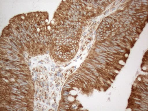 VAP33 / VAPA Antibody (aa2-227, clone OTI10E10)