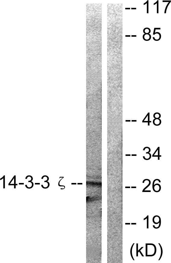 YWHAZ / 14-3-3 Zeta Antibody (p58)