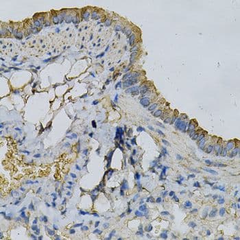 Polyclonal Rabbit anti-Human APRT Antibody (aa1-180, IHC, WB)