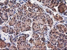 DSTN / Destrin Antibody (clone OTI2C10)