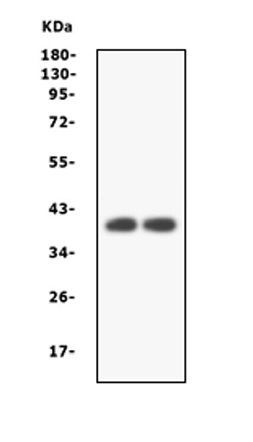 Polyclonal Rabbit anti-Human MAP2K3 / MEK3 / MKK3 Antibody (aa311-347, IHC, WB)