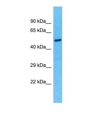 Polyclonal Rabbit anti-Human TEKT5 Antibody (aa101-150, WB)