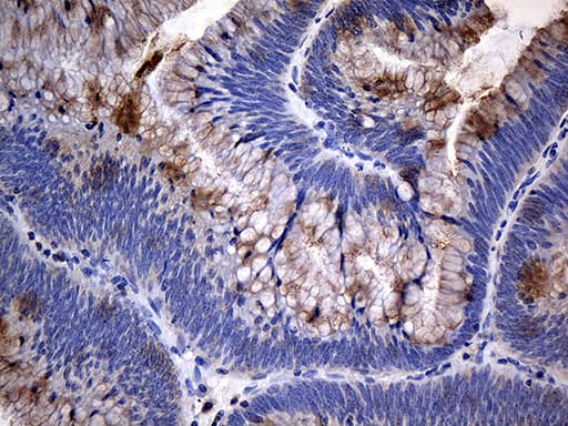 TANK Antibody (clone OTI1G2)