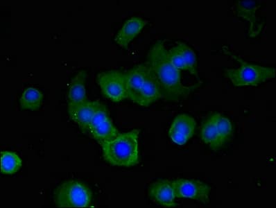 RPS6KA5 / MSK1 Antibody