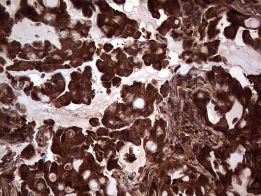 PKM2 Antibody (clone 1G10)