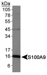 Polyclonal Rabbit anti-Human S100A9 / MRP14 Antibody (IF, WB)